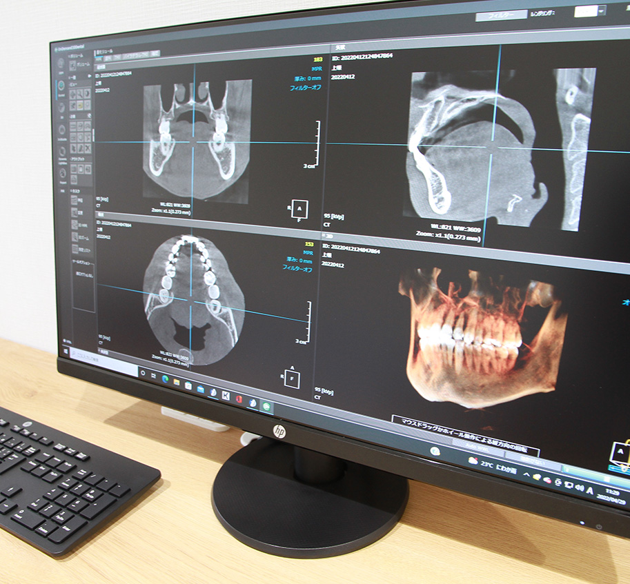 患者様説明用ソフト